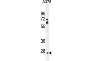 Image no. 1 for anti-Zinc Finger, CCHC Domain Containing 17 (ZCCHC17) (AA 159-187), (Middle Region) antibody (ABIN955641)
