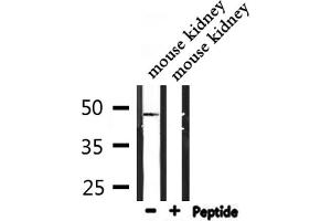 Image no. 3 for anti-Inositol Hexakisphosphate Kinase 2 (IP6K2) antibody (ABIN6262634)