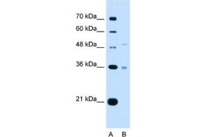 Image no. 1 for anti-Uronyl-2-Sulfotransferase (UST) antibody (ABIN2462994)