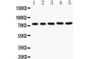 Image no. 2 for anti-Receptor (TNFRSF)-Interacting serine-threonine Kinase 1 (RIPK1) (AA 316-671) antibody (ABIN3042480)