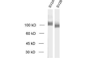 Image no. 1 for anti-Synaptic Vesicle Glycoprotein 2A (SV2A) (AA 2-17) antibody (ABIN1742256)