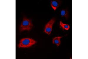 Image no. 1 for anti-Synapsin I (SYN1) (N-Term), (pSer9) antibody (ABIN2707753)