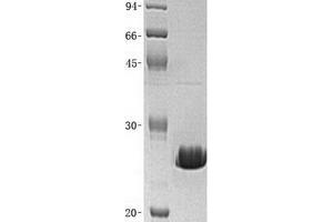 Image no. 1 for BCL2-Like 1 (BCL2L1) (Transcript Variant 2) protein (ABIN2715193)
