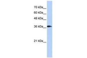 Image no. 1 for anti-ATPase, H+ Transporting, Lysosomal 38kDa, V0 Subunit D2 (ATP6V0D2) (C-Term) antibody (ABIN6741341)