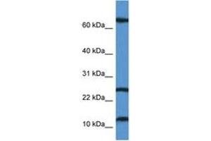 Image no. 1 for anti-TCR gamma Alternate Reading Frame Protein (TARP) (AA 7-56) antibody (ABIN6746905)