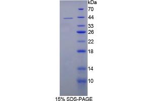 Image no. 1 for Interleukin 12 beta (IL12B) (AA 30-311) protein (His tag) (ABIN6236552)