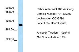 Image no. 1 for anti-Cysteinyl Leukotriene Receptor 1 (CYSLTR1) (C-Term) antibody (ABIN2788780)