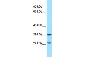 Image no. 1 for anti-Solute Carrier Family 25 (Mitochondrial Carrier, Dicarboxylate Transporter), Member 10 (SLC25A10) (Middle Region) antibody (ABIN2774446)