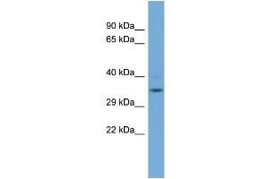 Image no. 2 for anti-Glyoxalase Domain Containing 4 (GLOD4) (N-Term) antibody (ABIN2786924)