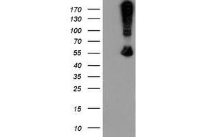 Image no. 9 for anti-rho GTPase Activating Protein 2 (ARHGAP2) antibody (ABIN1499627)