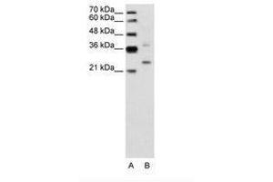 Image no. 2 for anti-Defective in Cullin Neddylation 1, Domain Containing 1 (DCUN1D1) (AA 31-80) antibody (ABIN6736642)