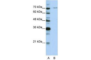 Image no. 1 for anti-PRP3 Pre-mRNA Processing Factor 3 Homolog (PRPF3) antibody (ABIN633259)