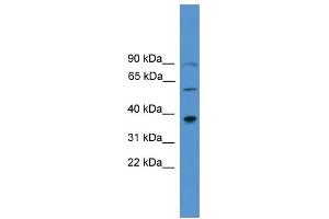 Image no. 1 for anti-Paired-Like Homeodomain 1 (PITX1) (Middle Region) antibody (ABIN2779577)