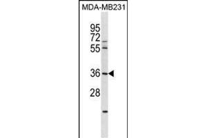 RN Antibody (N-term) (ABIN1538989 and ABIN2849752) western blot analysis in MDA-M cell line lysates (35 μg/lane).
