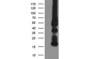 Image no. 3 for anti-Glycine Amidinotransferase (L-Arginine:glycine Amidinotransferase) (GATM) antibody (ABIN2722036)