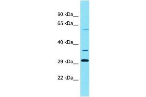 Image no. 1 for anti-Solute Carrier Family 22, Member 25 (SLC22A25) (Middle Region) antibody (ABIN2791416)