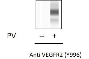 Image no. 2 for VEGF Receptor 2 (VEGFR2) ELISA Kit (ABIN5691026)