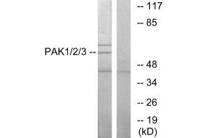 Image no. 2 for anti-P21-Activated Kinases 1/2/3 (PAK1/2/3) (Thr402), (Thr421), (Thr423) antibody (ABIN1847964)