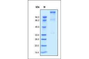 Image no. 1 for Insulin-Like Growth Factor 1 Receptor (IGF1R) (AA 31-932) (Active) protein (His tag) (ABIN2181260)