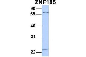Image no. 3 for anti-Zinc Finger Protein 185 (ZNF185) (N-Term) antibody (ABIN2780833)