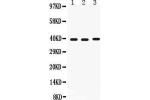 Image no. 1 for anti-Midkine (Neurite Growth-Promoting Factor 2) (MDK) (AA 21-143) antibody (ABIN3042356)