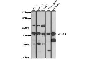 Image no. 1 for anti-Ankyrin Repeat and Zinc Finger Domain Containing 1 (ANKZF1) antibody (ABIN6290010)