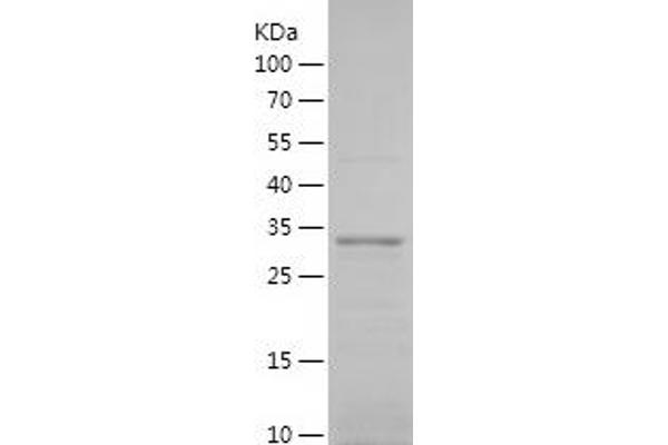 TMEM176B Protein (AA 1-65) (His-IF2DI Tag)