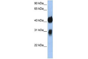 Image no. 1 for anti-Orthodenticle Homeobox 1 (OTX1) (C-Term) antibody (ABIN2792673)