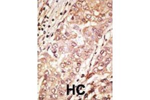 Image no. 2 for anti-Teratocarcinoma-Derived Growth Factor 1 (TDGF1) (AA 18-48), (N-Term) antibody (ABIN388791)
