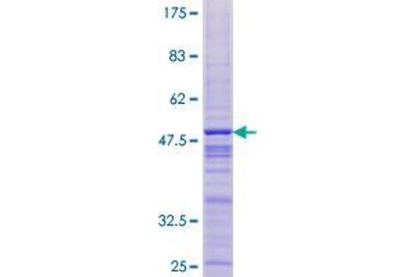 Thymocyte Nuclear Protein 1 (THYN1) (AA 1-166) protein (GST tag)