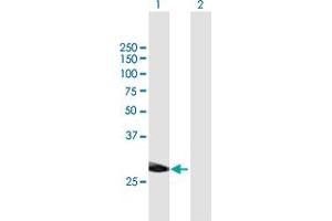 Image no. 2 for anti-Interferon-Induced Protein 35 (IFI35) (AA 1-288) antibody (ABIN516825)