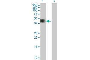 anti-Zinc and Ring Finger 4 (ZNRF4) (AA 1-429) antibody