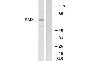 BMX antibody  (N-Term)
