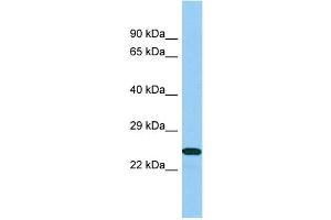 Image no. 1 for anti-B9 Protein Domain 1 (B9D1) (N-Term) antibody (ABIN2790914)