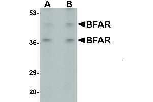 anti-Bifunctional Apoptosis Regulator (BFAR) (C-Term) antibody