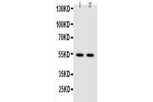 Image no. 1 for anti-Nuclear Factor of kappa Light Polypeptide Gene Enhancer in B-Cells 2 (NFKB2) (AA 5-21), (N-Term) antibody (ABIN3044018)