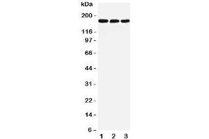Image no. 1 for anti-Low Density Lipoprotein Receptor-Related Protein 5 (LRP5) (C-Term) antibody (ABIN3031640)