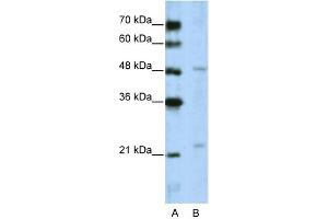 Image no. 1 for anti-WD Repeat Domain 12 (WDR12) (C-Term) antibody (ABIN2776745)