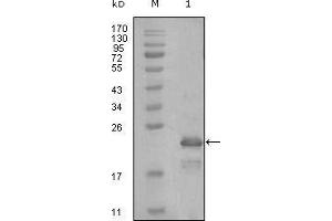Image no. 1 for anti-Heart and Neural Crest Derivatives Expressed 1 (HAND1) (AA 90-190) antibody (ABIN969184)