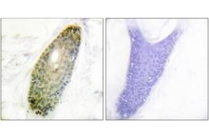 Immunohistochemistry analysis of paraffin-embedded human skin, using HDAC3 (Phospho-Ser424) Antibody.