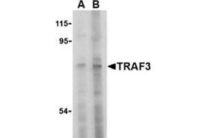 Image no. 2 for anti-TNF Receptor-Associated Factor 3 (TRAF3) (N-Term) antibody (ABIN501026)
