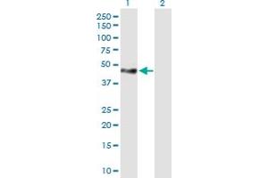 Image no. 1 for anti-Tensin 1 (TNS1) (AA 1-385) antibody (ABIN521038)