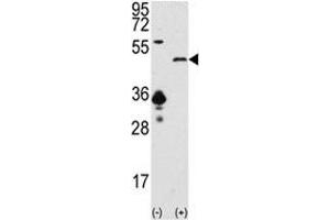Image no. 3 for anti-Sirtuin 7 (SIRT7) (AA 331-360) antibody (ABIN3032600)