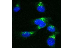 Image no. 2 for anti-USO1 Homolog, Vesicle Docking Protein (USO1) (Internal Region) antibody (ABIN351346)