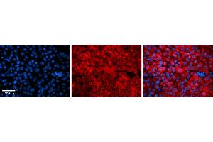 Image no. 2 for anti-Vacuolar-sorting Protein SNF8 (SNF8) (N-Term) antibody (ABIN2777633)