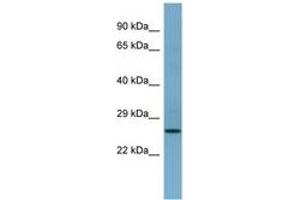 Image no. 1 for anti-APAF1 Interacting Protein (APIP) (AA 143-192) antibody (ABIN6741857)