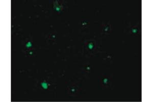 Image no. 1 for anti-Apoptotic Chromatin Condensation Inducer 1 (ACIN1) (C-Term) antibody (ABIN6655072)