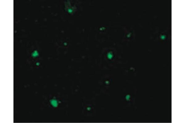 anti-Apoptotic Chromatin Condensation Inducer 1 (ACIN1) (C-Term) antibody