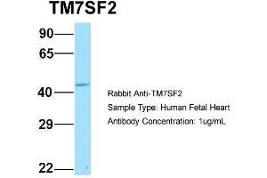 Image no. 1 for anti-Transmembrane 7 Superfamily Member 2 (TM7SF2) (N-Term) antibody (ABIN2782227)