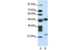 Image no. 2 for anti-PHD Finger Protein 11 (PHF11) (Middle Region) antibody (ABIN2776050)